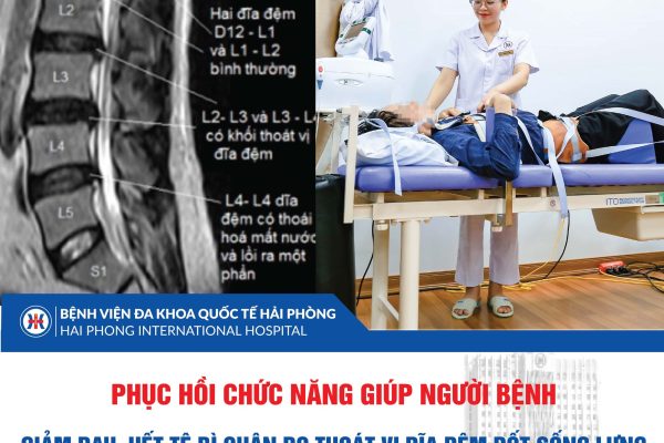 PHỤC HỒI CHỨC NĂNG GIÚP NGƯỜI BỆNH GIẢM ĐAU, HẾT TÊ BÌ CHÂN DO THOÁT VỊ ĐĨA ĐỆM ĐỐT SỐNG LƯNG