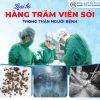 LOẠI BỎ HÀNG TRĂM VIÊN SỎI TRONG THẬN CHO NGƯỜI BỆNH