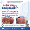 ĐIỀU TRỊ THÀNH CÔNG NGƯỜI BỆNH HOẠI TỬ THƯỢNG BÌ DO NHIỄM Đ.Ộ.C (HỘI CHỨNG SIS/TEN) HIẾM GẶP, DIỄN TIẾN N.G.U.Y H.I.Ể.M