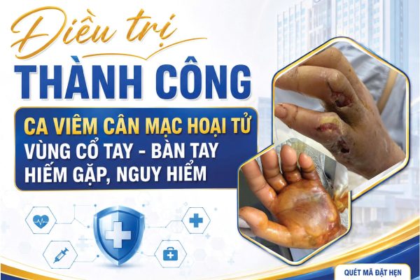 ĐIỀU TRỊ THÀNH CÔNG CA VIÊM CÂN MẠC H.O.Ạ.I T.Ử VÙNG CỔ TAY – BÀN TAY HIẾM GẶP, NGUY HIỂM